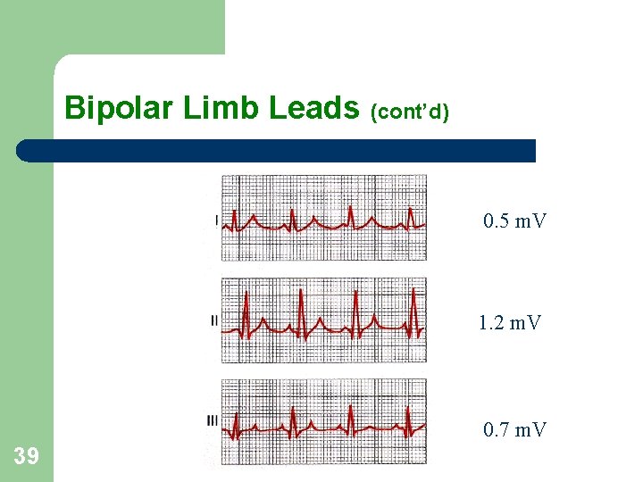 Bipolar Limb Leads (cont’d) 0. 5 m. V 1. 2 m. V 0. 7