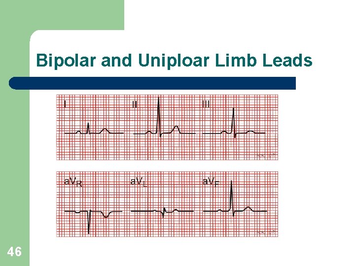 Bipolar and Uniploar Limb Leads 46 