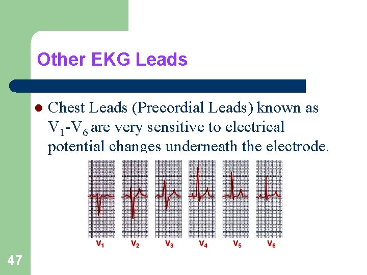 Other EKG Leads l 47 Chest Leads (Precordial Leads) known as V 1 -V
