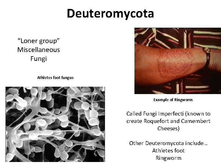 Deuteromycota “Loner group” Miscellaneous Fungi Athletes foot fungus Example of Ringworm Called Fungi Imperfecti