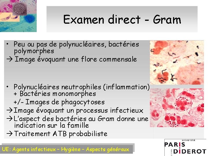 Examen direct - Gram • Peu ou pas de polynucléaires, bactéries polymorphes Image évoquant