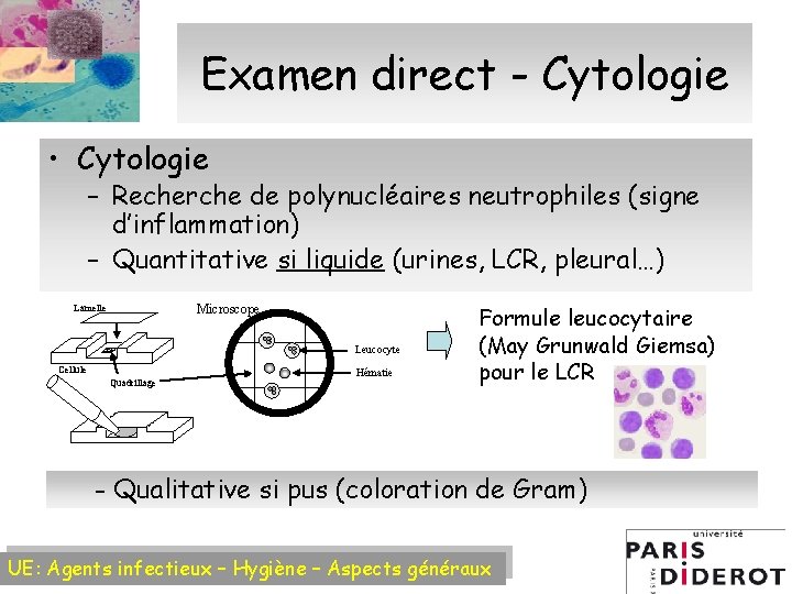 Examen direct - Cytologie • Cytologie – Recherche de polynucléaires neutrophiles (signe d’inflammation) –