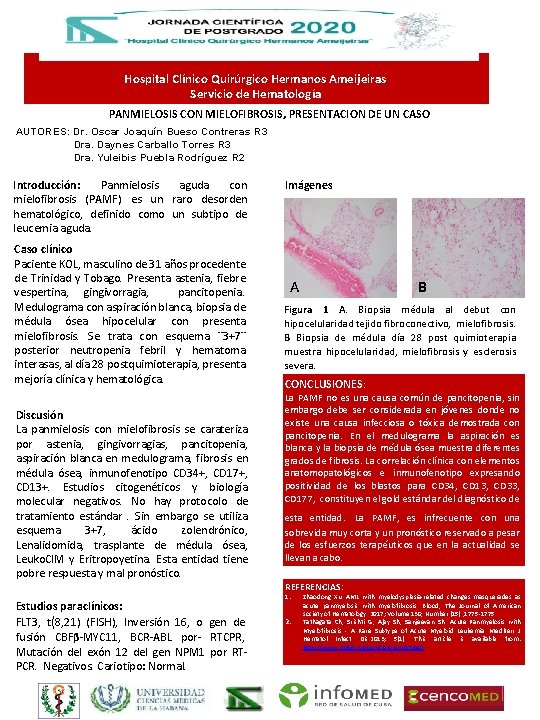 Hospital Clínico Quirúrgico Hermanos Ameijeiras Servicio de Hematología PANMIELOSIS CON MIELOFIBROSIS, PRESENTACION DE UN