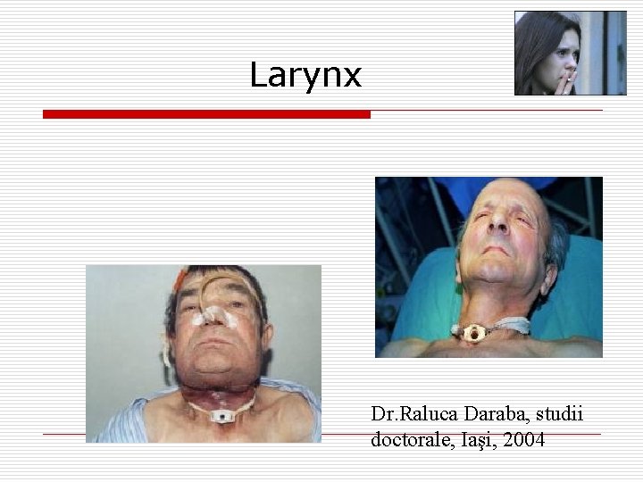 Larynx Dr. Raluca Daraba, studii doctorale, Iaşi, 2004 