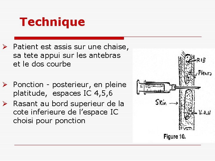 Technique Ø Patient est assis sur une chaise, sa tete appui sur les antebras