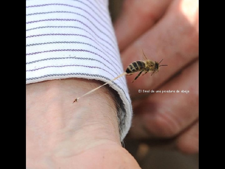 El final de una picadura de abeja 