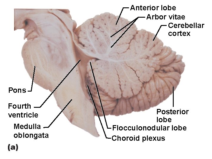 Anterior lobe Arbor vitae Cerebellar cortex Pons Fourth ventricle Medulla oblongata Posterior lobe Flocculonodular