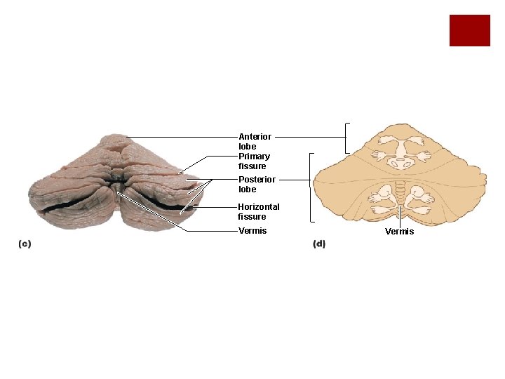 Anterior lobe Primary fissure Posterior lobe Horizontal fissure Vermis 