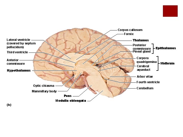 Corpus callosum Fornix Lateral ventricle (covered by septum pellucidum) Thalamus Posterior commissure Pineal gland