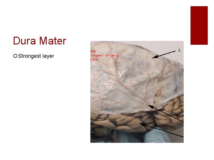 Dura Mater ¡ Strongest layer 