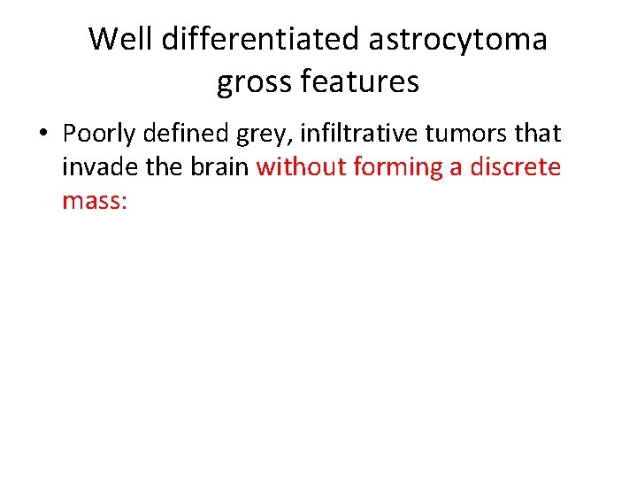 Well differentiated astrocytoma gross features • Poorly defined grey, infiltrative tumors that invade the