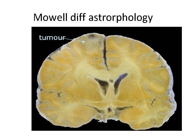 Mowell diff astrorphology 