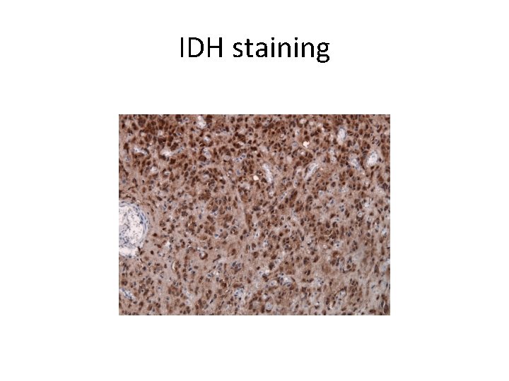 IDH staining 