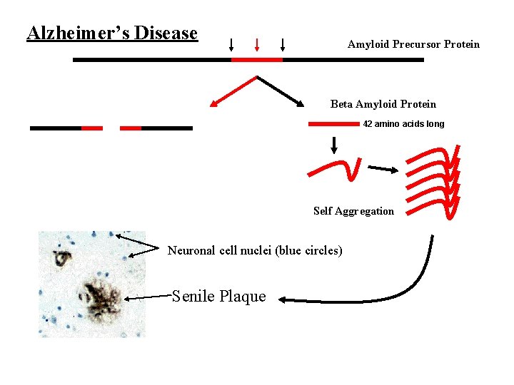 Alzheimer’s Disease Amyloid Precursor Protein Beta Amyloid Protein 42 amino acids long Self Aggregation