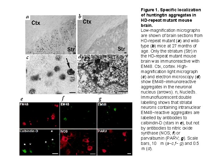 Figure 1. Specific localization of huntingtin aggregates in HD-repeat mutant mouse brain. Low-magnification micrographs
