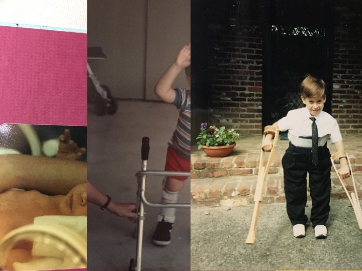 Students with Disabilities • Multiple disabilities &/or complex health needs • Frequent surgeries. .