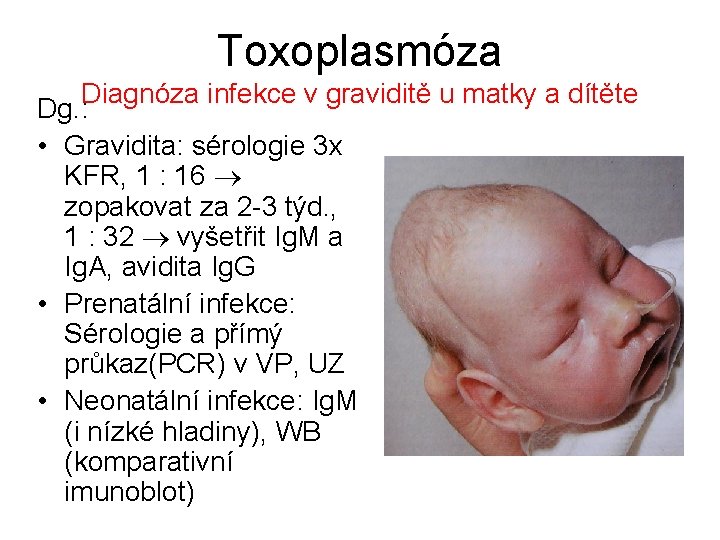 Toxoplasmóza Diagnóza infekce v graviditě u matky a dítěte Dg. : • Gravidita: sérologie