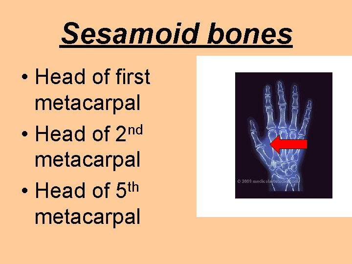 Sesamoid bones • Head of first metacarpal nd • Head of 2 metacarpal th