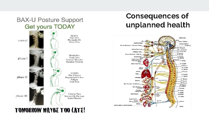 Consequences of unplanned health 