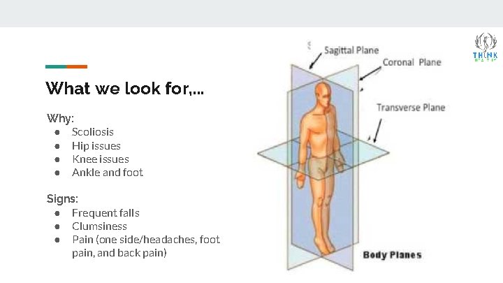 What we look for, . . . Why: ● Scoliosis ● Hip issues ●