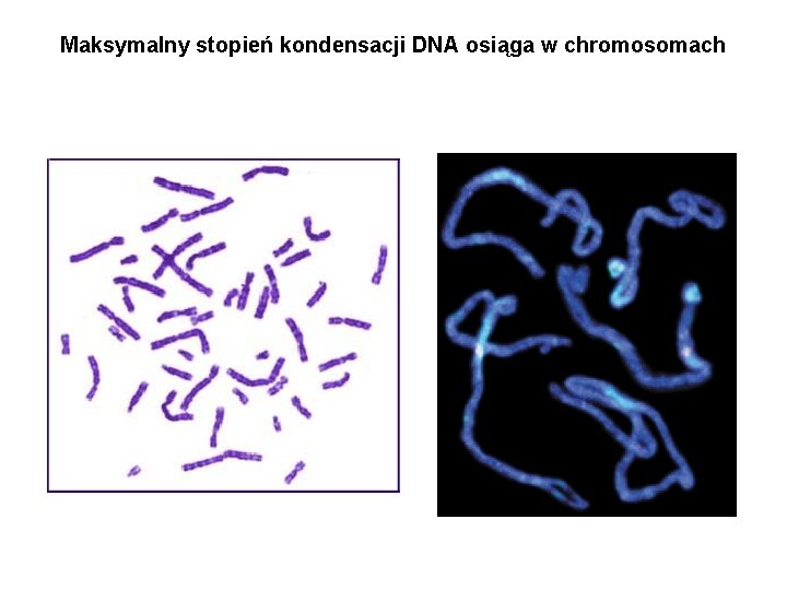 Maksymalny stopień kondensacji DNA osiąga w chromosomach 