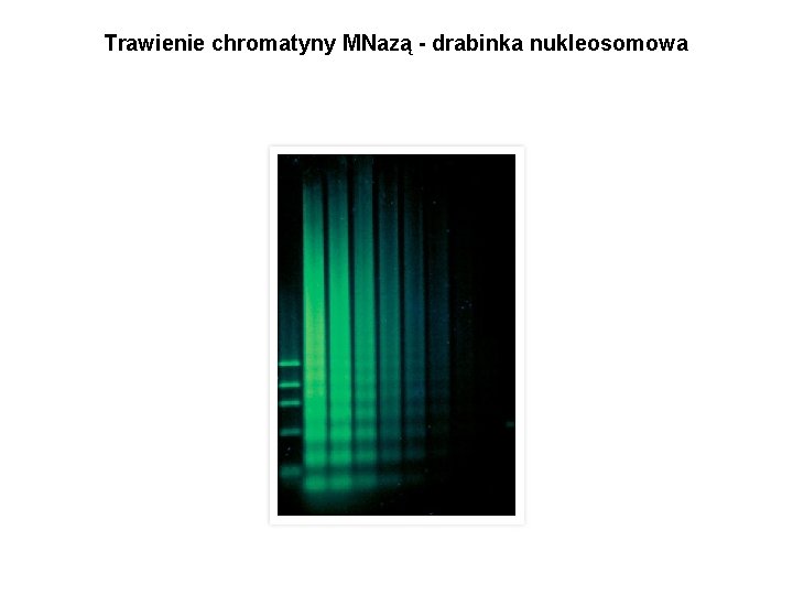 Trawienie chromatyny MNazą - drabinka nukleosomowa 
