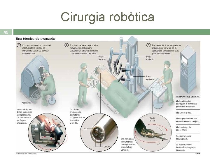 Cirurgia robòtica 45 