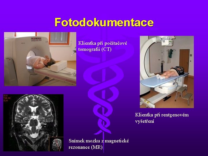 Fotodokumentace Klientka při počítačové tomografii (CT) Klientka při rentgenovém vyšetření Snímek mozku z magnetické