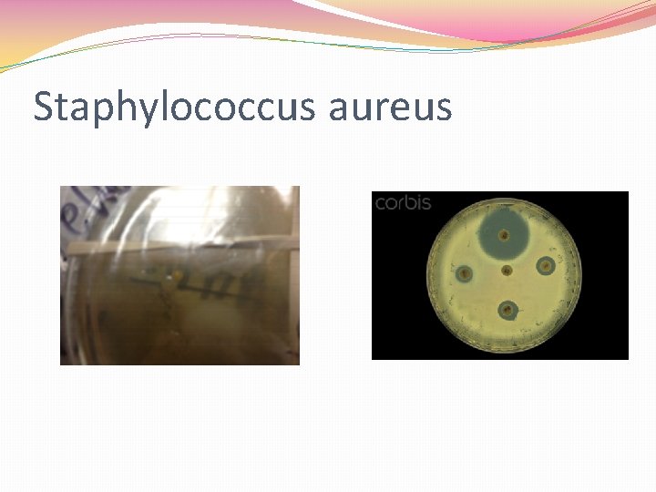 Staphylococcus aureus 