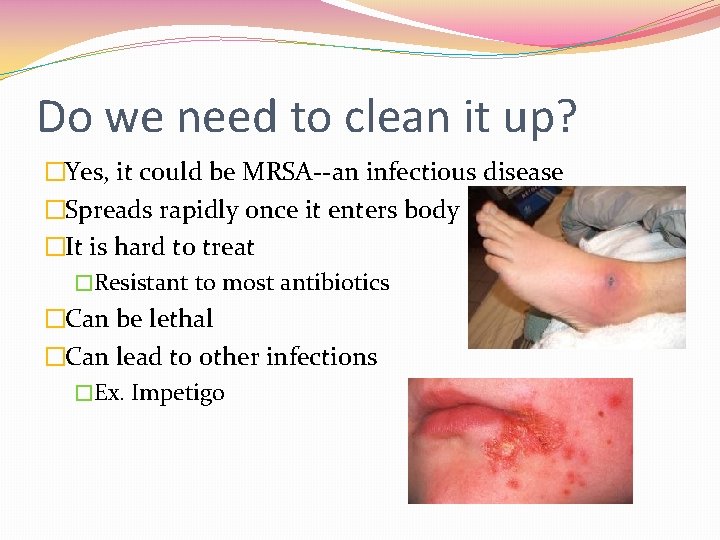Do we need to clean it up? �Yes, it could be MRSA--an infectious disease