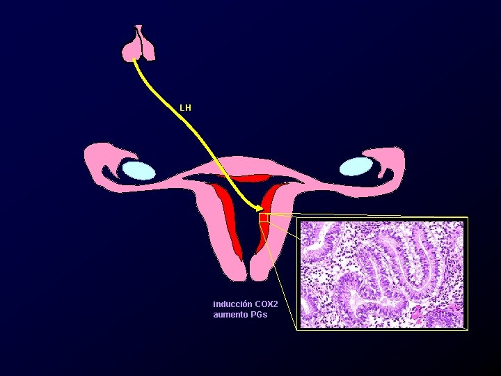 LH inducción COX 2 aumento PGs 