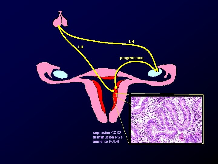 LH LH progesterona supresión COX 2 disminución PGs aumento PGDH 
