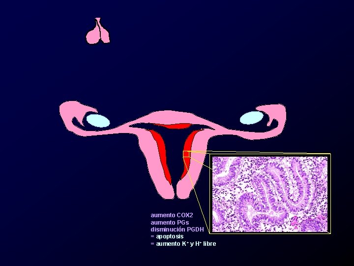 aumento COX 2 aumento PGs disminución PGDH = apoptosis = aumento K+ y H+