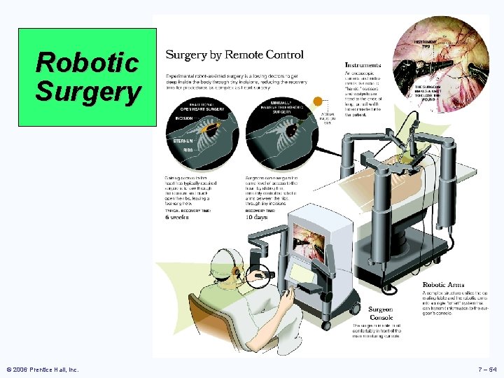 Robotic Surgery © 2006 Prentice Hall, Inc. 7 – 54 