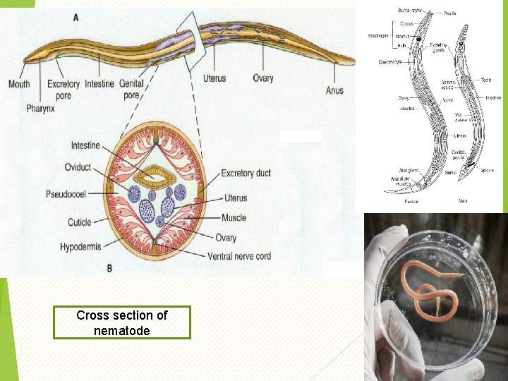 Cross section of nematode 