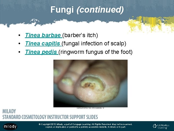 Fungi (continued) • Tinea barbae (barber’s itch) • Tinea capitis (fungal infection of scalp)
