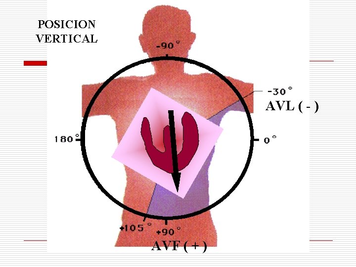 POSICION VERTICAL AVL ( - ) AVF ( + ) POSICION VERTICAL AVL ( - ) AVF ( + )