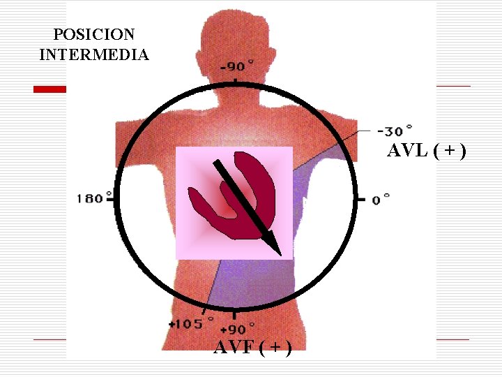 POSICION INTERMEDIA AVL ( + ) AVF ( + ) POSICION INTERMEDIA AVL ( + ) AVF ( + )