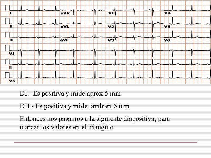 DI. - Es positiva y mide aprox 5 mm DII. - Es positiva y DI. - Es positiva y mide aprox 5 mm DII. - Es positiva y