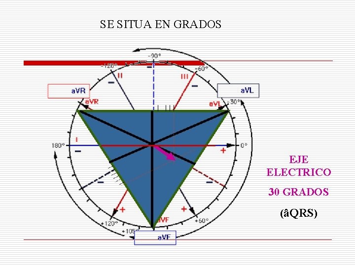 SE SITUA EN GRADOS EJE ELECTRICO 30 GRADOS (âQRS) SE SITUA EN GRADOS EJE ELECTRICO 30 GRADOS (âQRS)