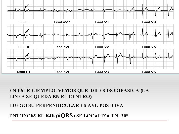 EN ESTE EJEMPLO, VEMOS QUE DII ES ISODIFASICA (LA LINEA SE QUEDA EN EL EN ESTE EJEMPLO, VEMOS QUE DII ES ISODIFASICA (LA LINEA SE QUEDA EN EL