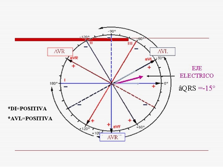EJE ELECTRICO âQRS =-15° *DI=POSITIVA *AVL=POSITIVA EJE ELECTRICO âQRS =-15° *DI=POSITIVA *AVL=POSITIVA