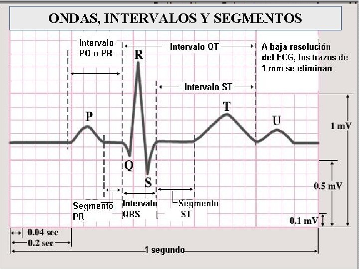 ONDAS, INTERVALOS Y SEGMENTOS ONDAS, INTERVALOS Y SEGMENTOS