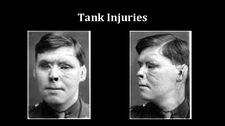 Tank Injuries 