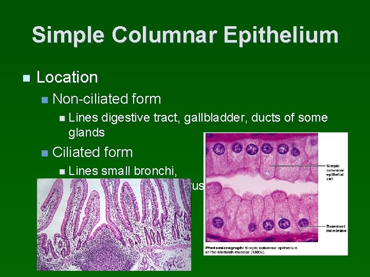 Simple Columnar Epithelium n Location n Non-ciliated form n Lines digestive tract, gallbladder, ducts