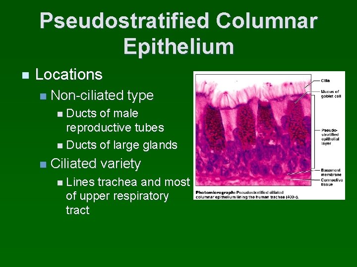 Pseudostratified Columnar Epithelium n Locations n Non-ciliated type n Ducts of male reproductive tubes