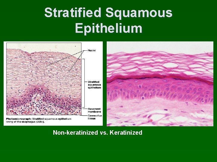 Stratified Squamous Epithelium Non-keratinized vs. Keratinized 