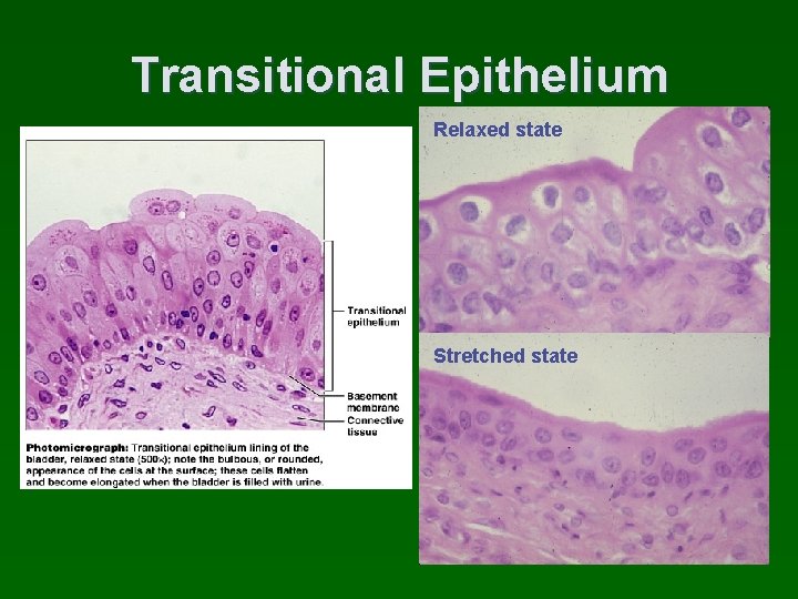 Transitional Epithelium Relaxed state Stretched state 