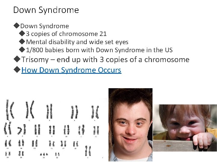 Down Syndrome 3 copies of chromosome 21 Mental disability and wide set eyes 1/800