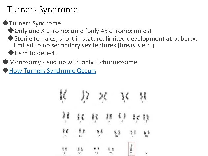 Turners Syndrome Only one X chromosome (only 45 chromosomes) Sterile females, short in stature,